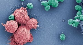 Microscopy image of colorized immune cells. 