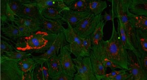 Fluorescent microscopy image of senescent cells