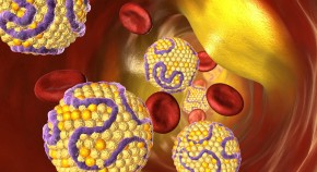 Blood cells within a vessel with atherosclerosis