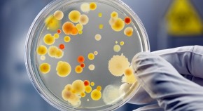 Petri dish with cultures of different colours