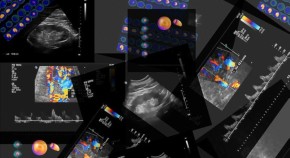 Medical imaging data for digital diagnostics