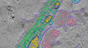 SEM of microtubules surrounding cellular vesicles.