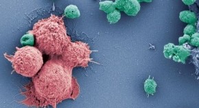 electronic microscope image of cancer cells and T cells together