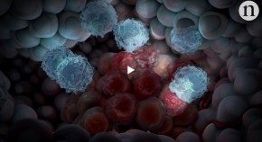 Immune cells attacking cancer cells
