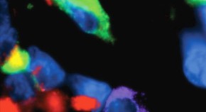 Immunofluorescent staining of human melanocytic specimens