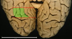 brain evolution research articles