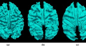 brain evolution research articles