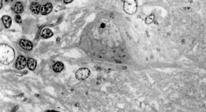 brain evolution research articles brain evolution research articles