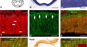 brain evolution research articles