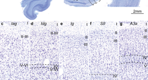 brain evolution research articles