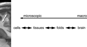 brain evolution research articles