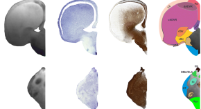 brain evolution research articles