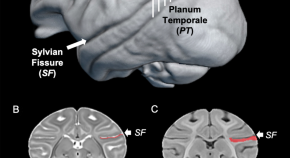 brain evolution research articles