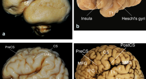 brain evolution research articles