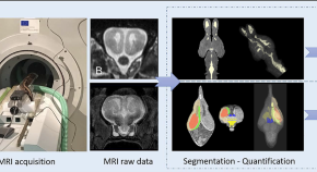 brain evolution research articles