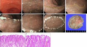 Surgical Endoscopy 7/2021