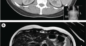 nursing case study endocrine system