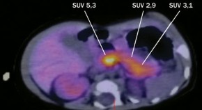 endocrine case study for nursing