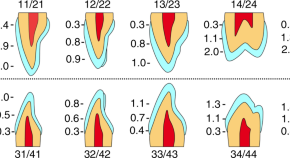 recent library dissertation topics in prosthodontics