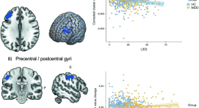 research topic about students depression