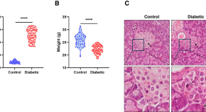 current research being done on type 1 diabetes