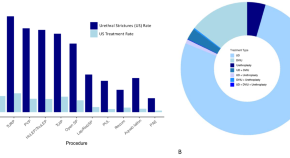 prostate cancer research reports