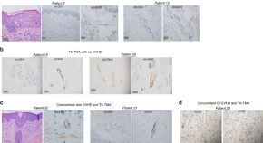 research article on cancer cells