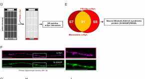 latest research parkinson's disease