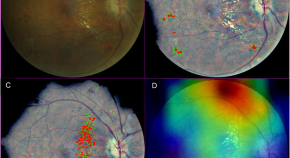 new research topics in ophthalmology