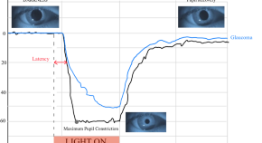 research topics in ophthalmology