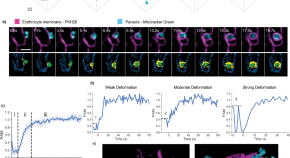 research on malaria diagnosis