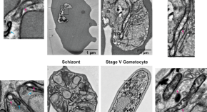 research on malaria diagnosis