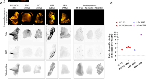 neurological disease research paper