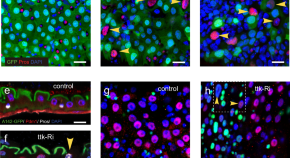 latest research on stem cell therapy