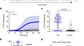 parkinson's disease research paper outline