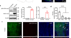 parkinson's disease research paper outline