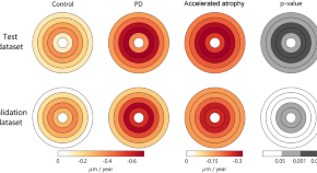 neurological disease research paper