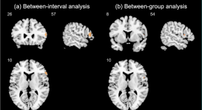 articles about schizophrenia research