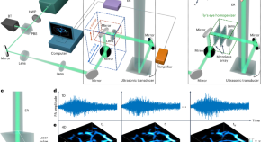 topics for research in ultrasound