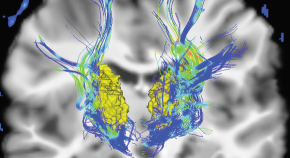 latest research topics in neurosurgery