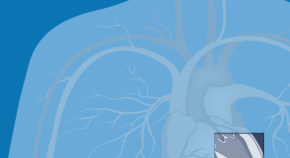topics for research in ultrasound topics for research in ultrasound