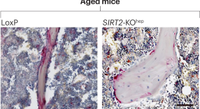 new research on osteoporosis