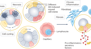 medical research kidney diseases