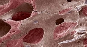 new research on osteoporosis new research on osteoporosis