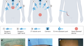 medical surgical research topics