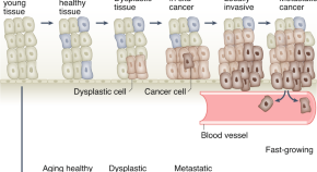 new cancer research 2022