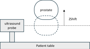 prostate cancer research