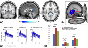 research papers on neurobiology