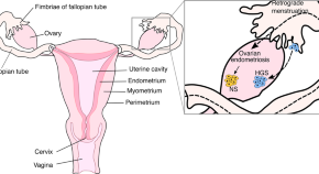 research paper on cancer biology