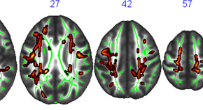 research papers on neurobiology